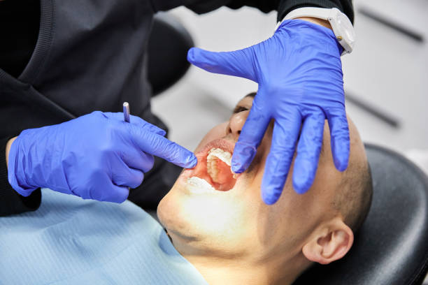 Best Emergency Dental Care for Trauma or Injury in South Miami Heights, FL